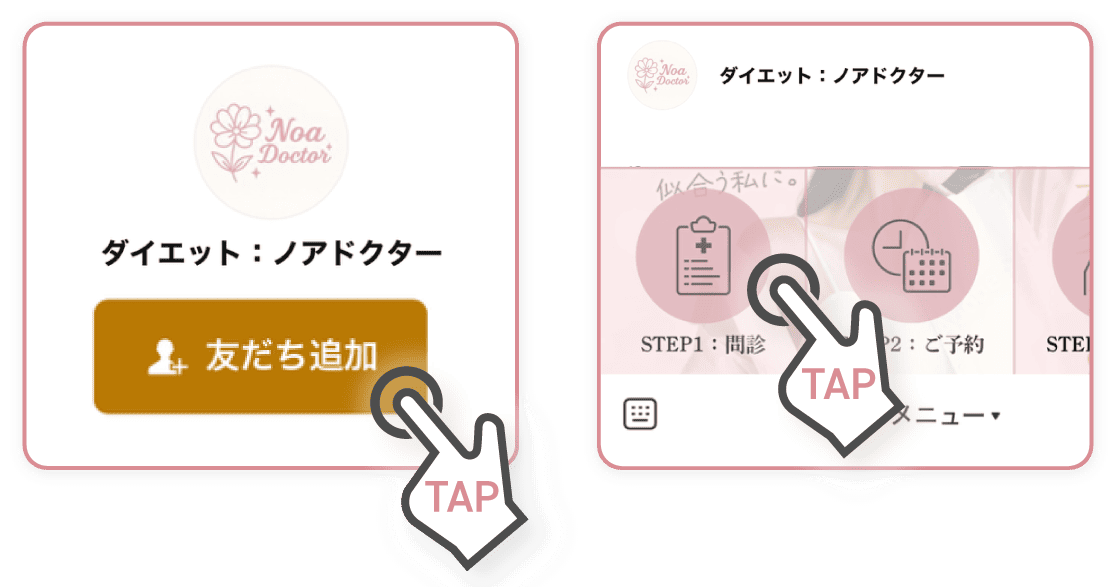友達登録して問診に進む
